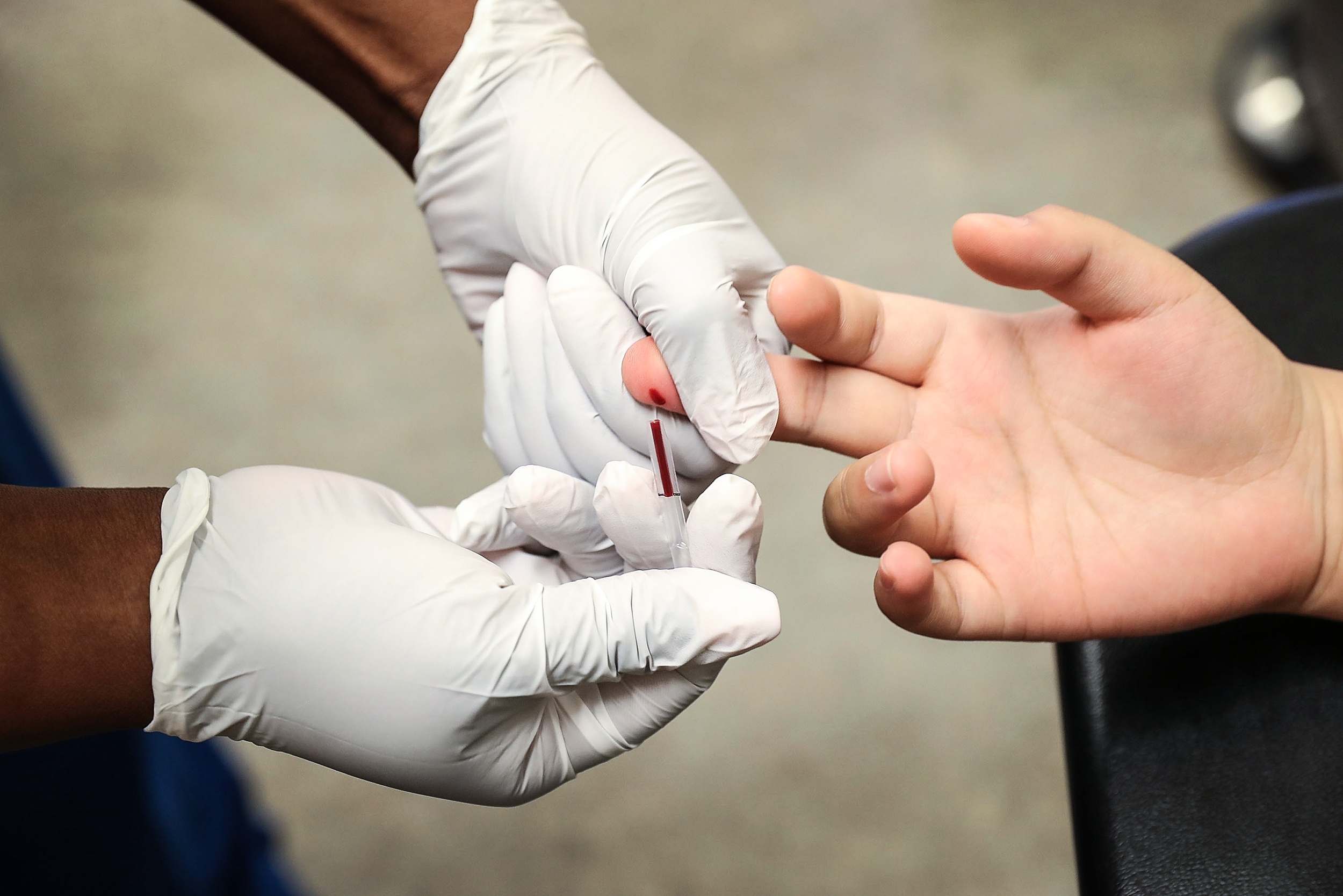 chung virus HIV moi voi doc luc cao anh 3