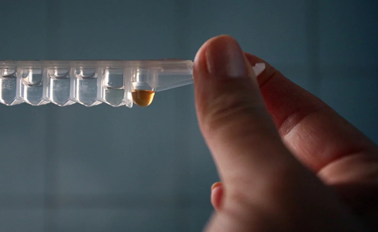 chung virus HIV moi voi doc luc cao anh 2