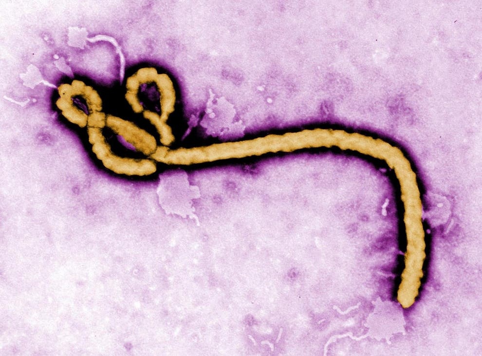 Virus Ebola ảnh 1 Virus Ebola anh 1