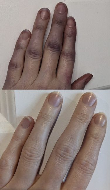 Thuốc điều trị di chứng hậu Covid-19 ảnh 4 Thuoc dieu tri di chung hau Covid-19 anh 4