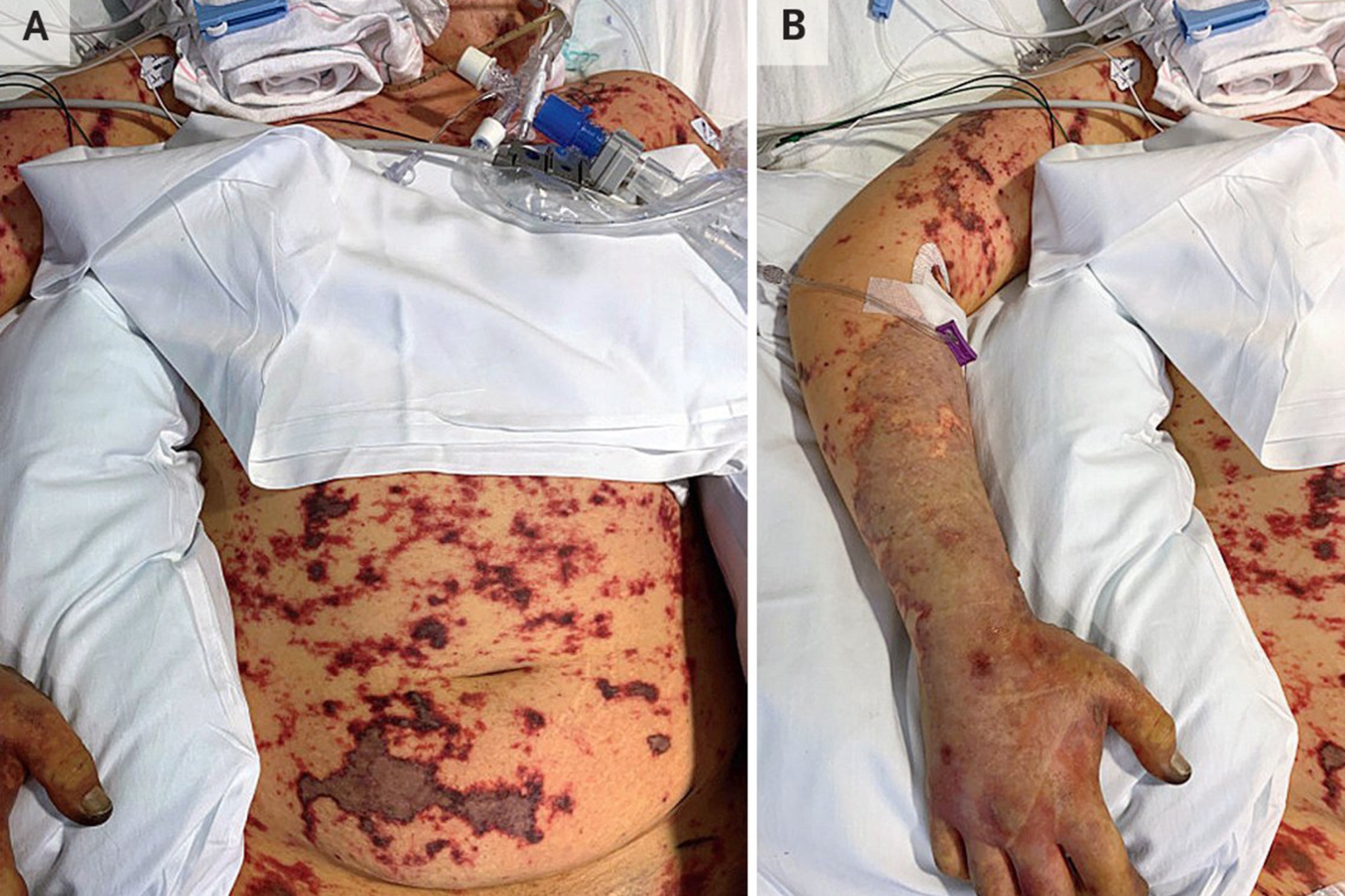 Cat cut chan vi an thuc pham thua anh 1