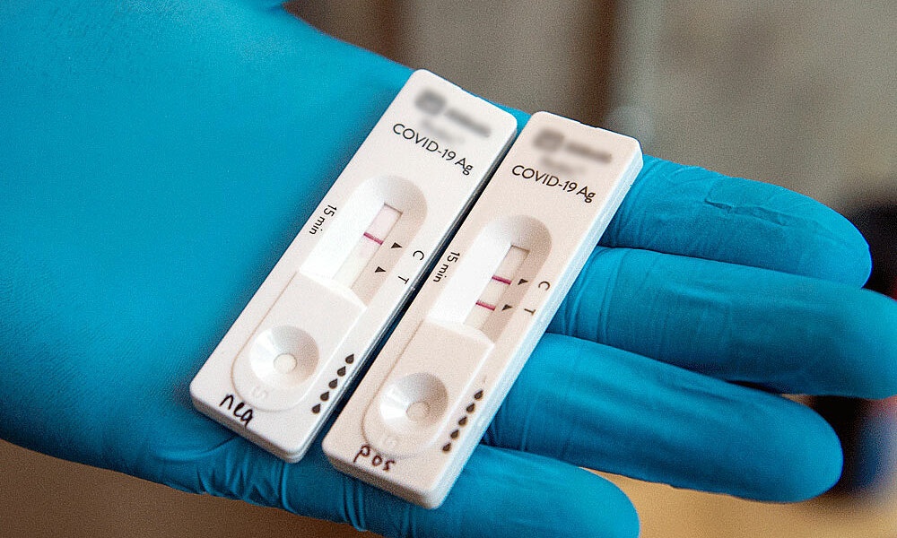 Vach kit test Covid-19 luc mo luc dam co y nghia gi? hinh anh