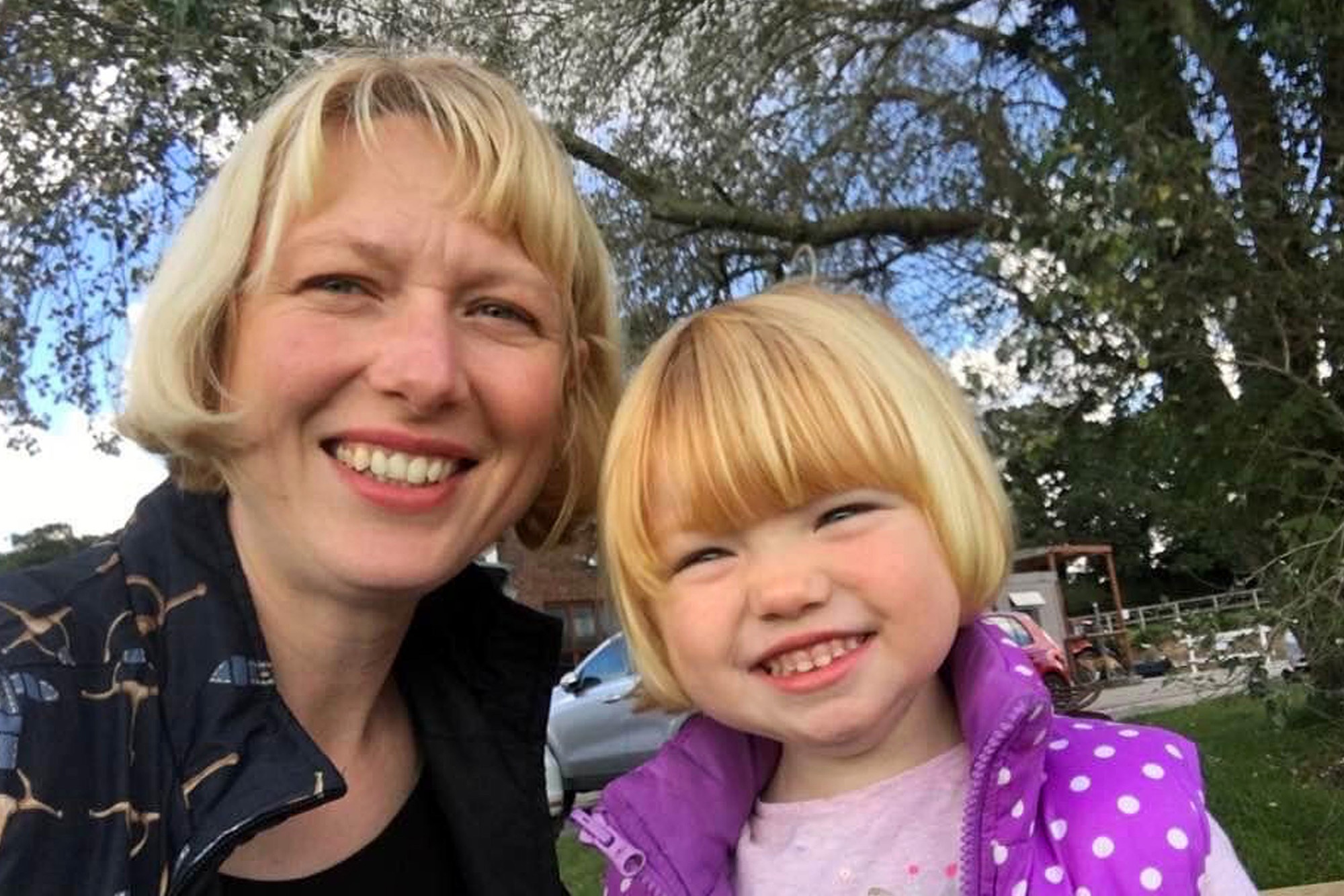 Bé gái không có tóc ảnh 1 Be gai khong co toc anh 1