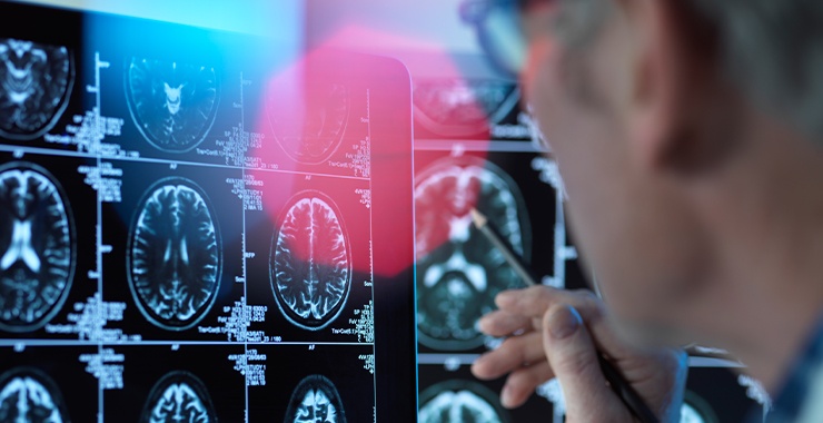 di chung o nguoi khoi Covid-19 anh 2