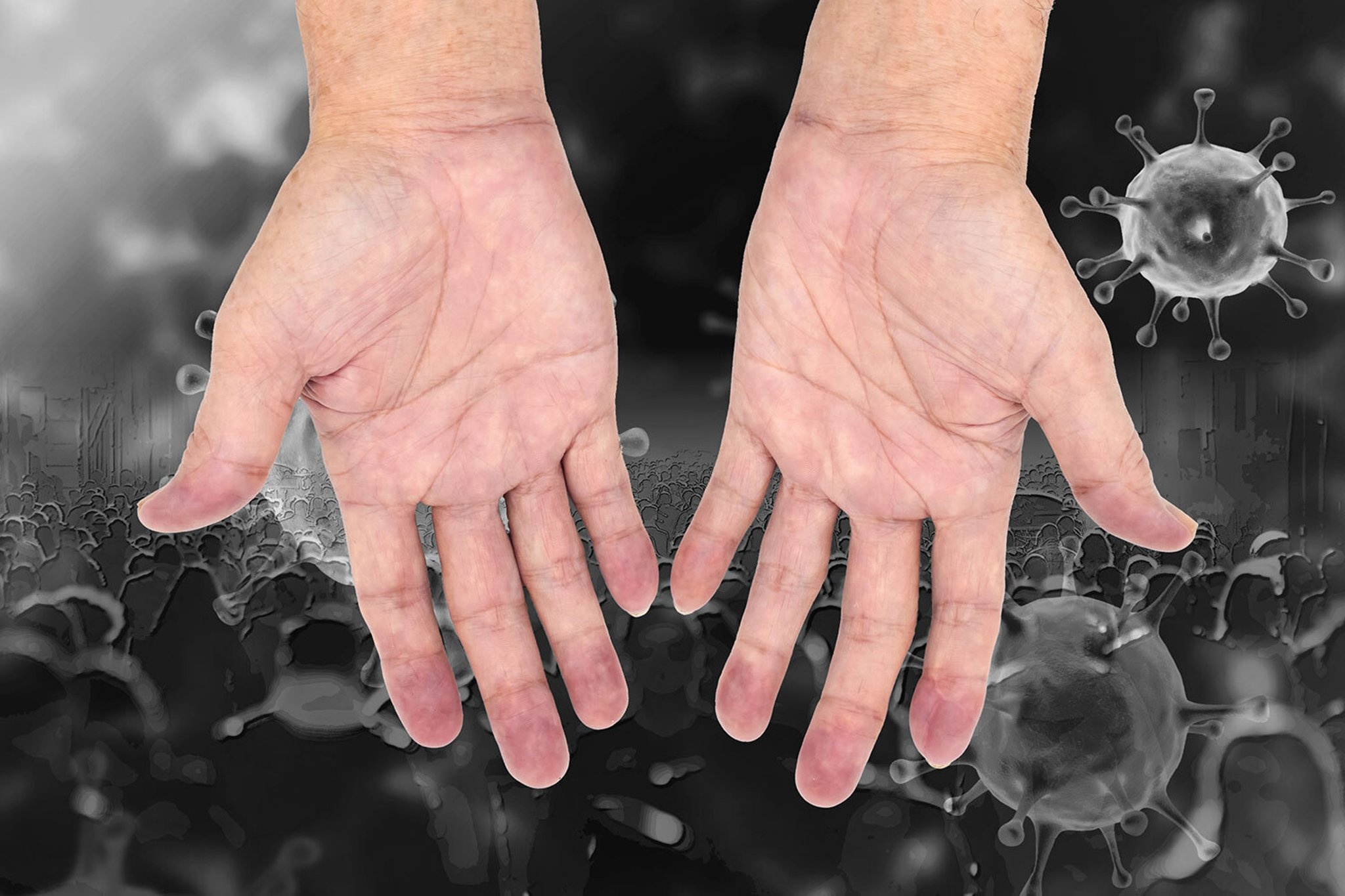 Omicron co the ton tai va lay nhiem sau bao lau bam vao da nguoi? hinh anh