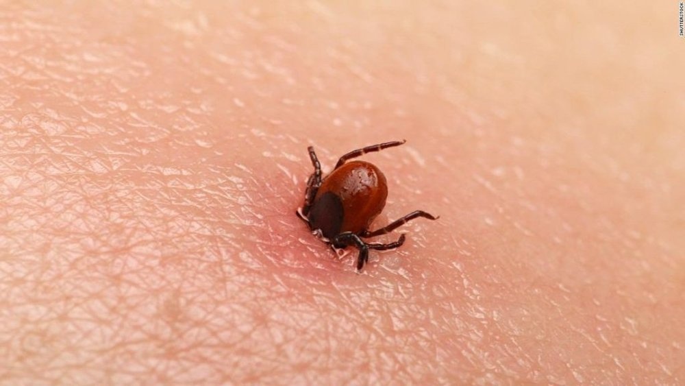 Loai virus gay tu vong len toi 40% xuat hien tai Anh hinh anh