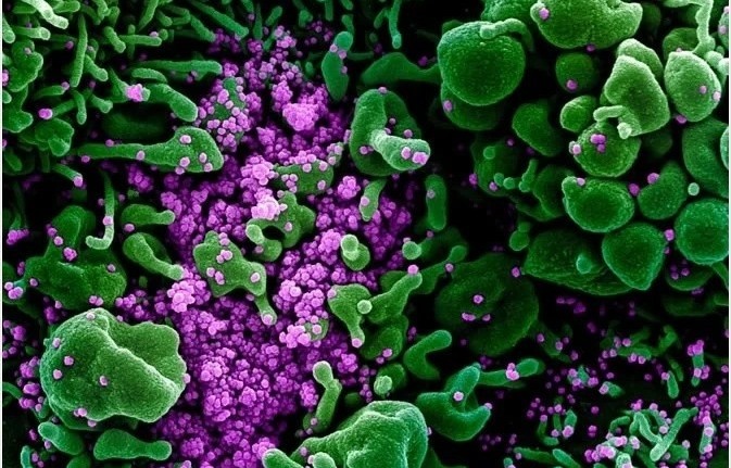 Tuyen bo khac biet ve Covid-19 hinh anh