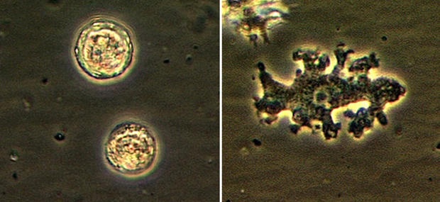 Virus ảnh 3 Virus anh 3