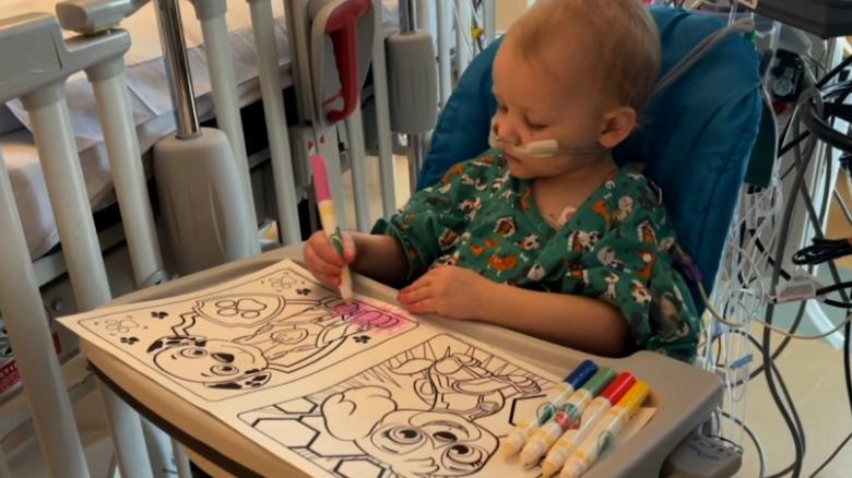 Viem gan bi an anh 3