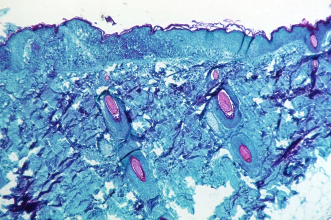 Phat hien moi khi giai trinh tu bo gene cua virus dau mua khi hinh anh
