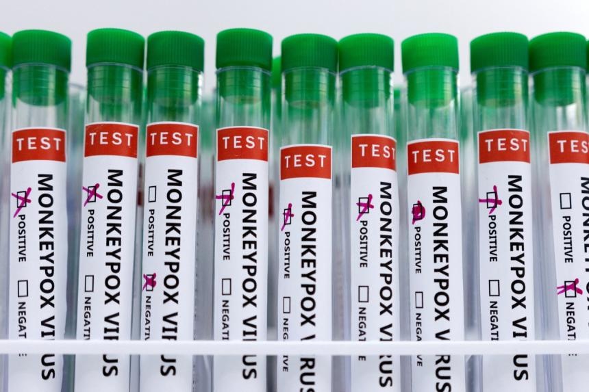 Anh mo rong tiem vaccine dau mua khi cho toan dan hinh anh