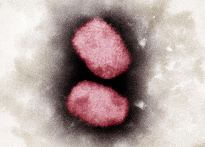 Tim thay virus dau mua khi trong tinh dich nguoi benh hinh anh