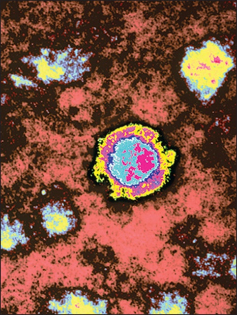 Virus gây bệnh Borna ảnh 1 Virus gay benh Borna anh 1