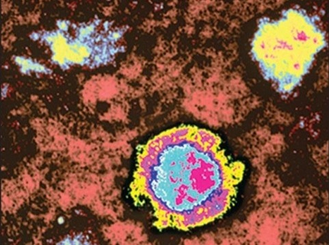 Virus hiem gay tu vong gan 100% 'tai xuat' hinh anh