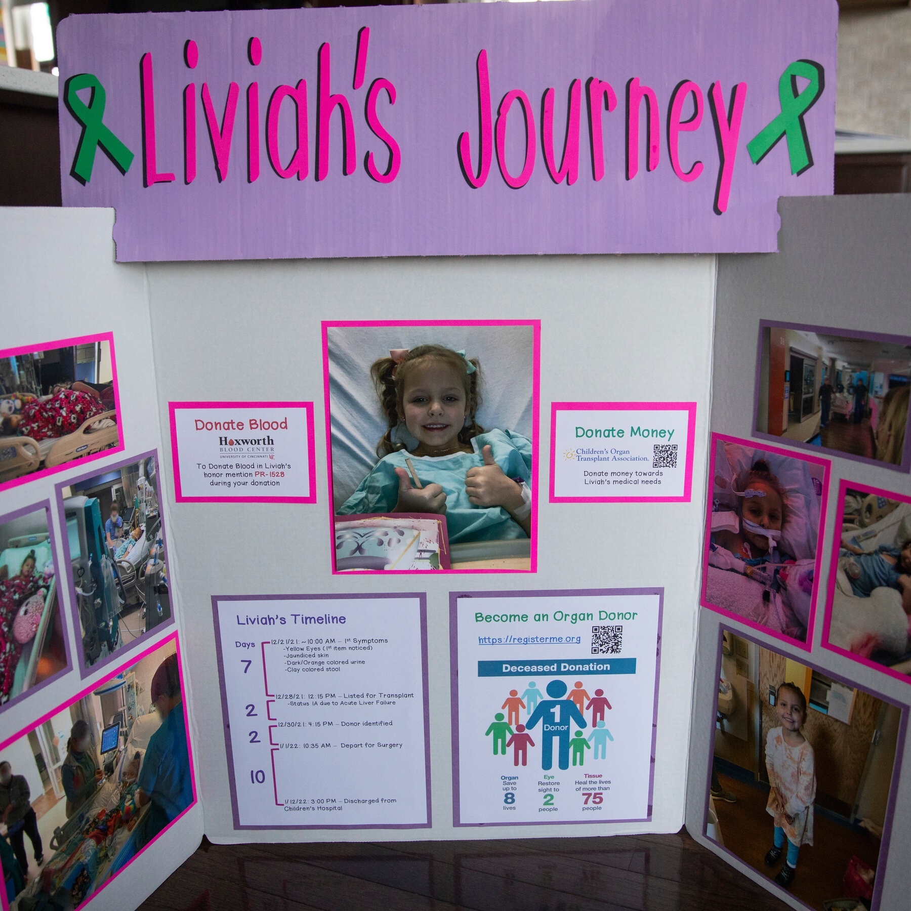 viem gan bi an anh 3