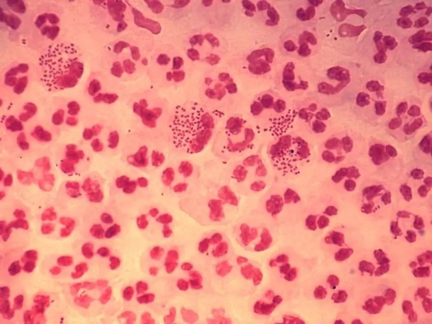 mac benh ‘sieu lau’ sau tinh mot dem anh 1