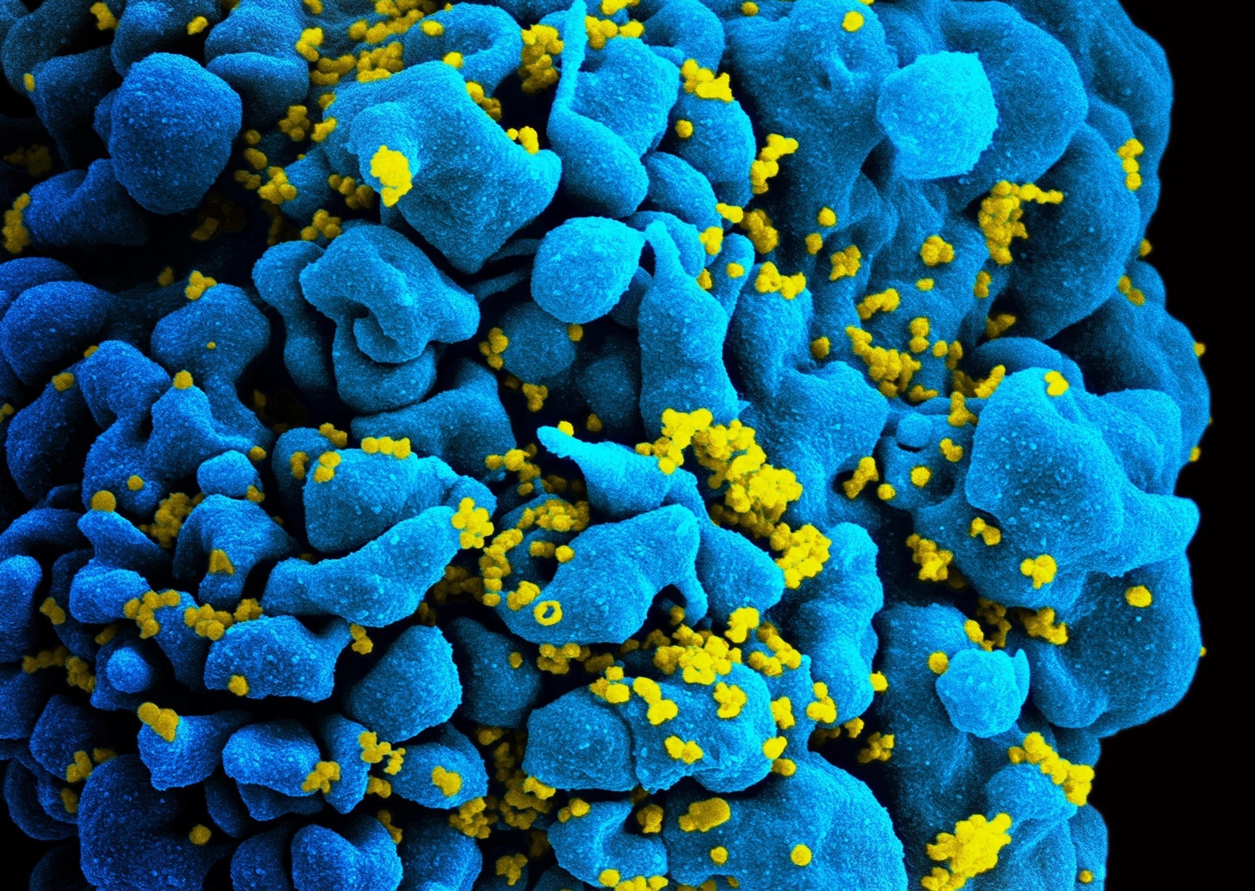 Phuong phap moi co the chua khoi AIDS chi bang mot mui tiem hinh anh