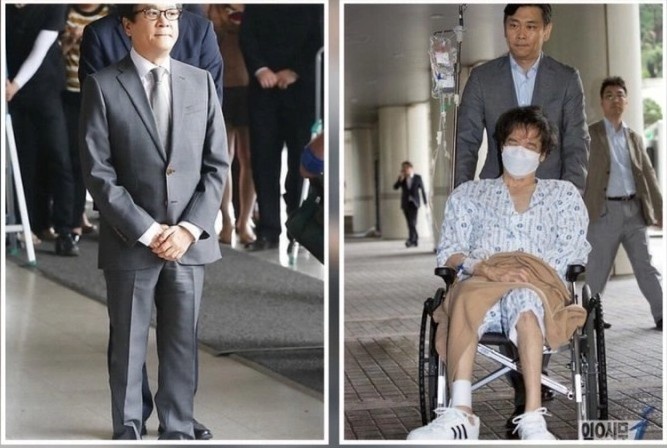 Bệnh di truyền teo cơ mác ảnh 3 Benh di truyen teo co mac anh 3