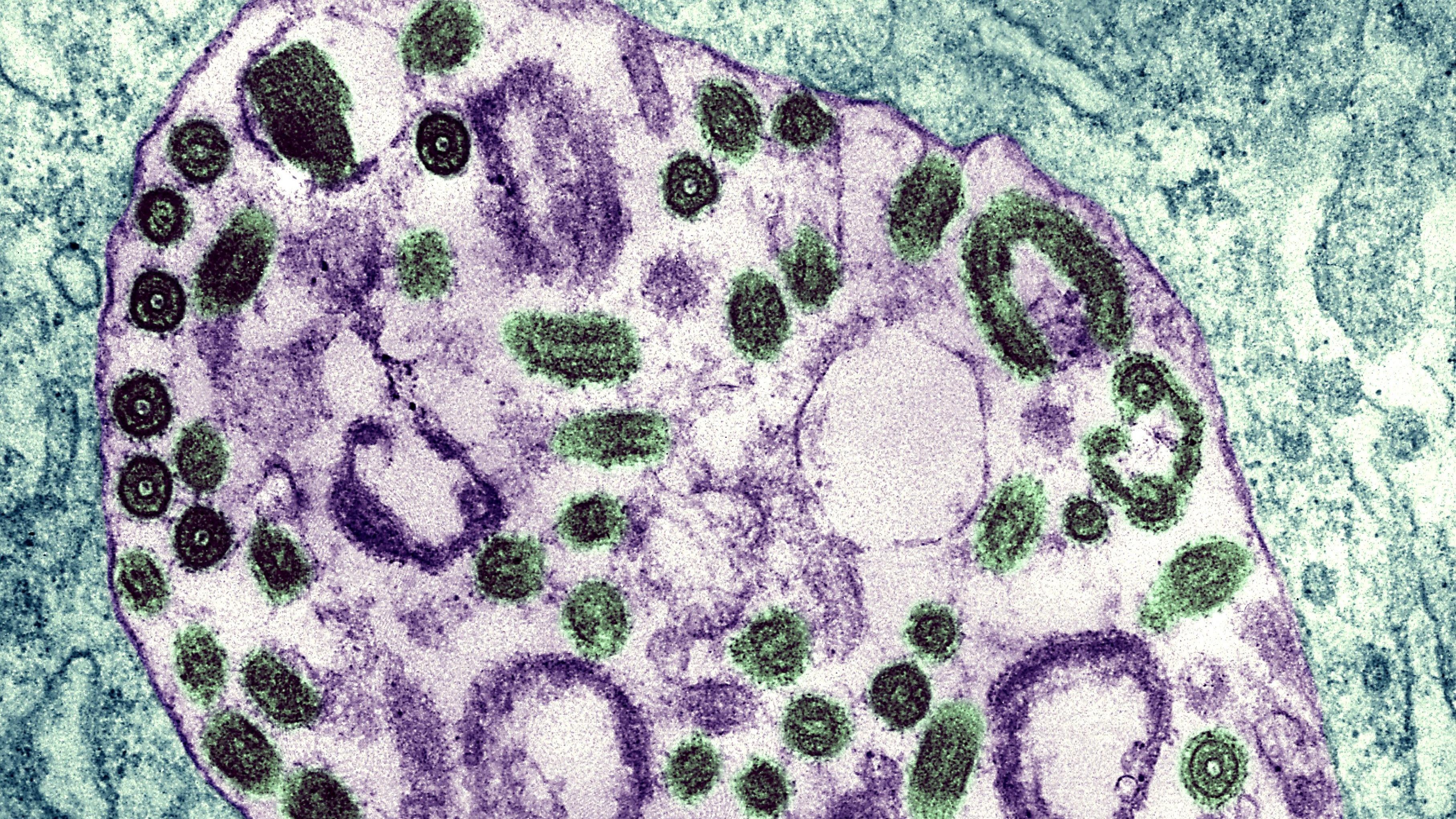 Dich benh bi an gay chet nguoi anh 1