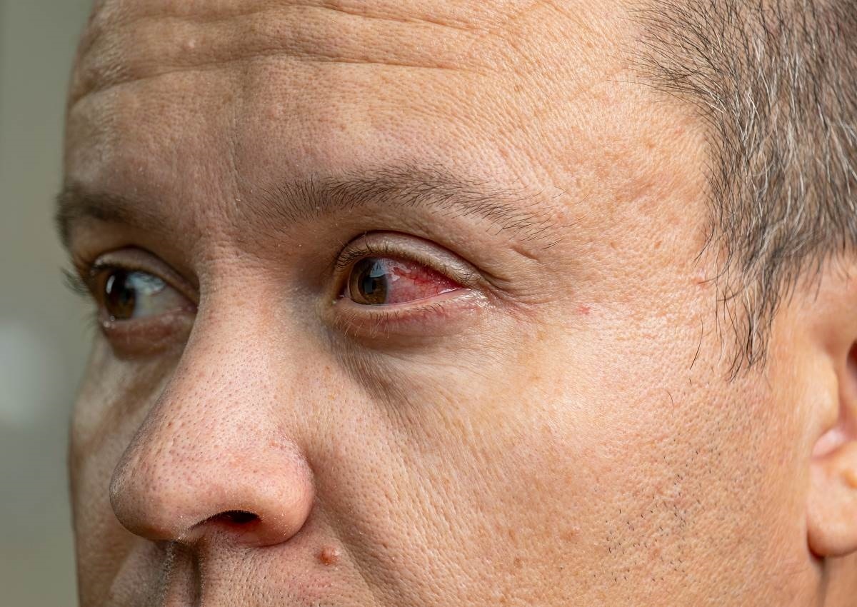 Can benh khien nguoi mac tu vong sau khi khoc ra mau hinh anh