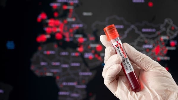 Dau mua khi lay lan nhanh o Singapore hinh anh