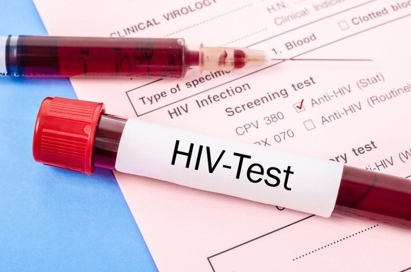 Nhiem HIV sau khi di xam o An Do hinh anh