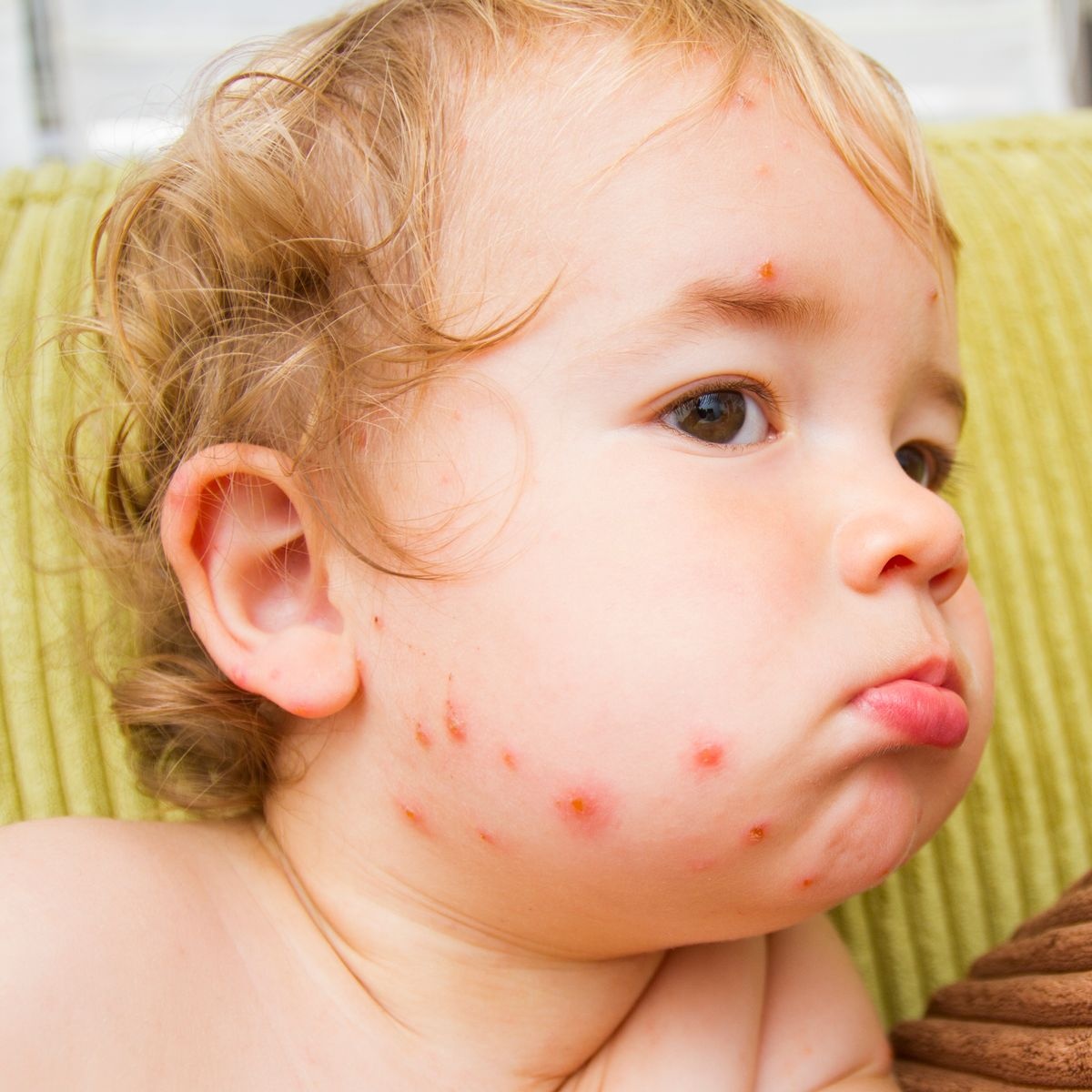 dau mua khi o tre anh 2