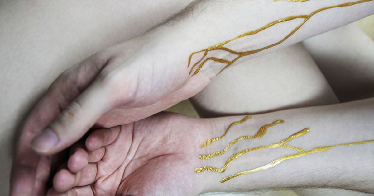 Phat hien hai phu nu mang nhom mau vang, the gioi chua den 50 nguoi co hinh anh