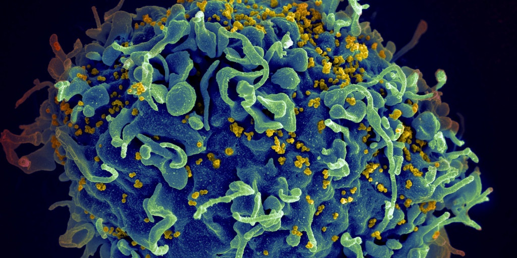 virus giống HIV ảnh 1 virus giong HIV anh 1