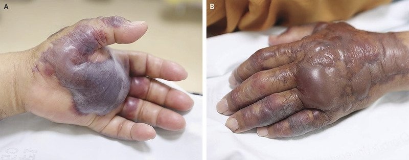 vi khuan an thit nguoi anh 1