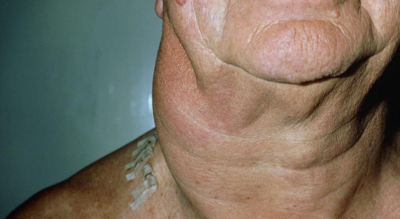 Jisoo sung hach anh 1