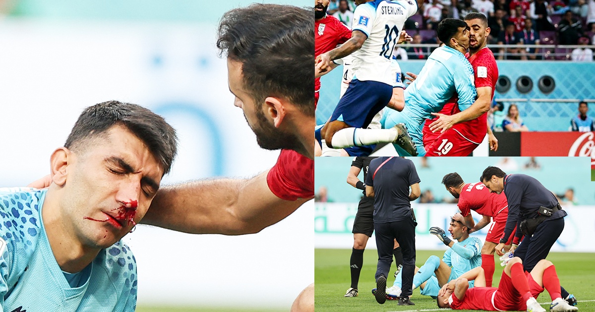 thu mon Iran chan thuong anh 1