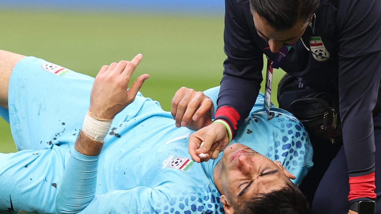 chấn thương world cup ảnh 1 chan thuong world cup anh 1