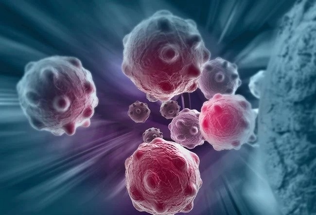 Ca benh ung thu la lung nhat lich su hinh anh