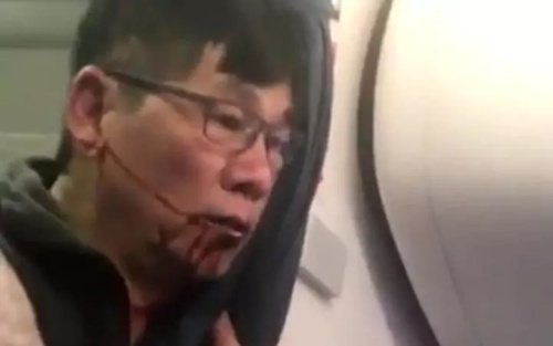 United Airlines dat thoa thuan hoa giai voi ong David Dao hinh anh