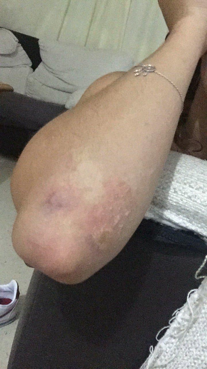 Cầu trượt dài nhất Tây Ban Nha đóng cửa sau 24h ảnh 2 Cau truot dai nhat Tay Ban Nha dong cua sau 24h anh 2