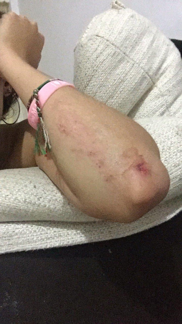 Cầu trượt dài nhất Tây Ban Nha đóng cửa sau 24h ảnh 3 Cau truot dai nhat Tay Ban Nha dong cua sau 24h anh 3