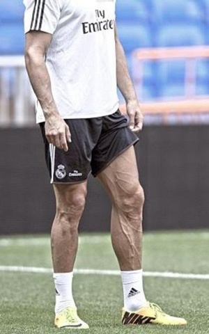 Doi chan hiem hoa cua Ronaldo hinh anh