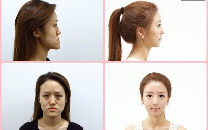 Anh vui chau A: Dua than phau thuat tham my hinh anh