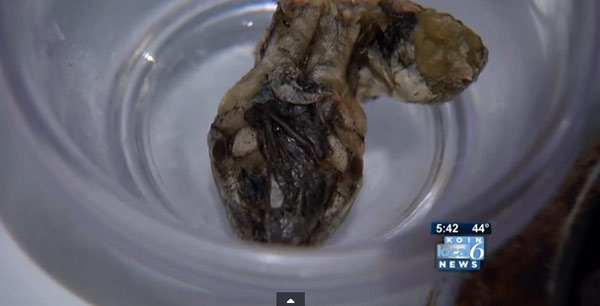 Phat hien dau ran trong tui dau dong lanh hinh anh