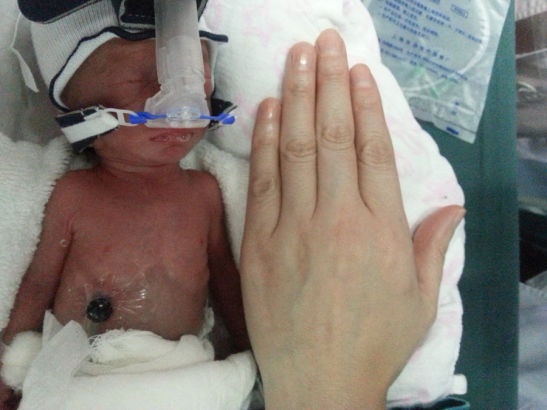 Be so sinh nho bang long ban tay hinh anh