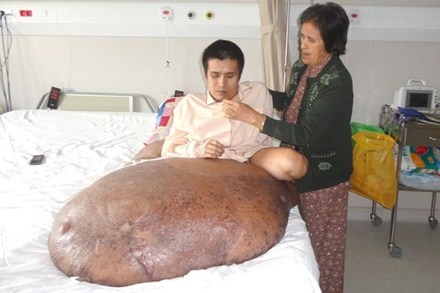 Phep mau cua chang trai co chan voi khong lo hinh anh