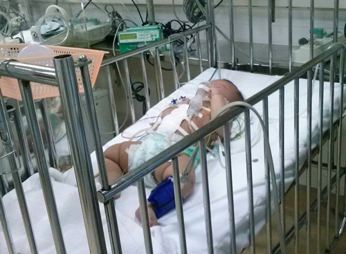 Be 4 thang tuoi bi dam thung bung da qua con nguy kich hinh anh