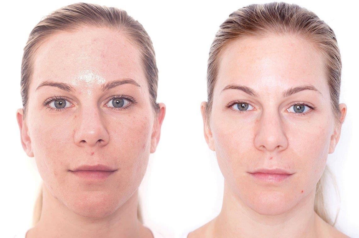 cồn phá hủy làn da ảnh 1 con pha huy lan da anh 1