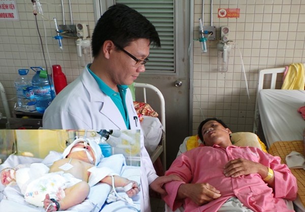 Su song dieu ky cua hai dua tre hinh anh