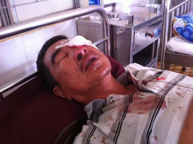 Nem da xe khach… cho vui hinh anh