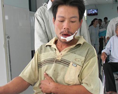 Khan truong dieu tra vu chu long ca bi truy sat trong dem hinh anh