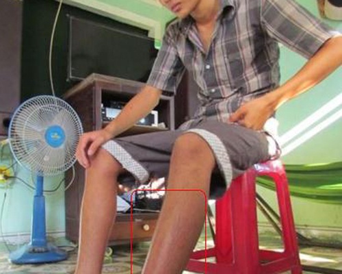 Da co 135 nguoi bi ran luc duoi do tan cong o Quang Ngai hinh anh