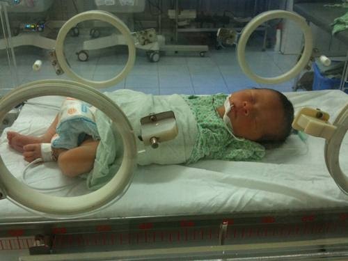 Cuu song be so sinh va san phu ngung tim khi dang chuyen da hinh anh