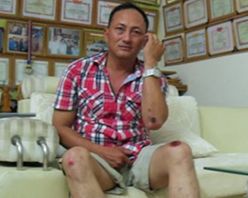 Truy duoi cuop, hiep sy Tien 'cop' bi cuop ban thuong tich hinh anh